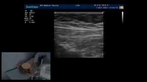 Практическое занятие: УЗИ молочных желез