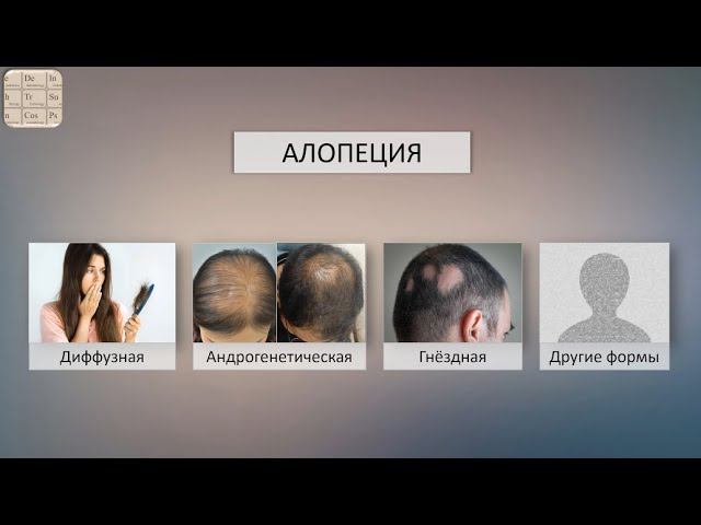 Важные отличия между разными формами алопеции