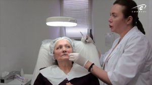 Филлер для носогубной складки. Контурная пластика филлер Princess.