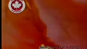Реклама Гарньер интенсивный уход 2008 год