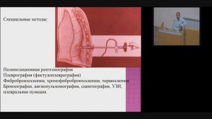 Эмпиема плевры