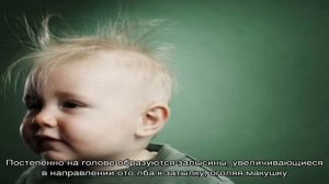 Алопеция: причины и лечение у детей