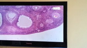 Гистология Препарат Яичник Окраска Гематоксилин+эозин (Женская половая)