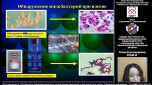 Культуральная диагностика возбудителя туберкулёза