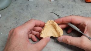 №19 - Изготовление съёмного протеза из ацетала (Perflex Acetal - все этапы)