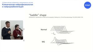 Поверхностная электромиография и декремент при миастении