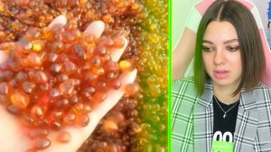 СМОТРИ САМЫЕ ВИРУСНЫЕ ВИДЕО! Колючки на руке