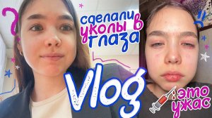 Vlog Cделали МИНИ ОПЕРАЦИЮ на глаза  ЕГЭшные будни