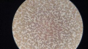 Как КАЛИНА влияет на мою кровь