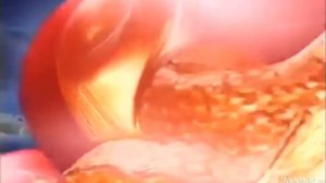 Самый Умный Заставка (Небольшая реконструкция)