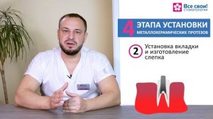 Зубные мосты - этапы установки циркониевых зубных мостов и металлокерамических мостовидных протезов