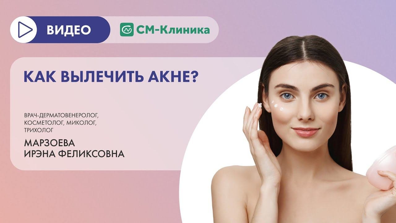 Как вылечить акне?