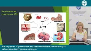 16.06. 2021 г. «Проявление на слизистой оболочке полости рта заболеваний внутренних органов»