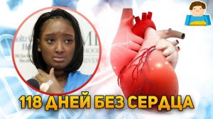 Эта девочка прожила 118 дней без сердца! | Plushkin