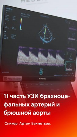 11 часть УЗИ брахиоцефальных артерий и брюшной аорты на Mindray Resona i9