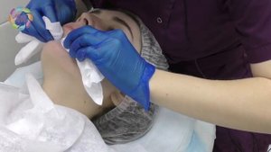 Механическая чистка лица | Роял Медик