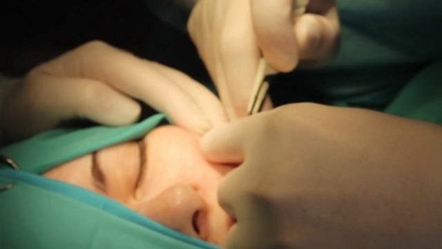 Хирургическое удаление доброкачественных новообразований кожи