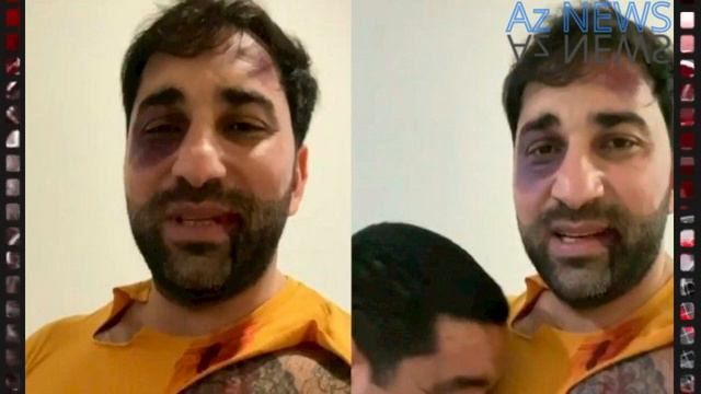 Kamil Zeynallı ətrafında nə baş verir? - "Döyülmə" fotolarını kim yayır? (VİDEO) смотреть онлайн