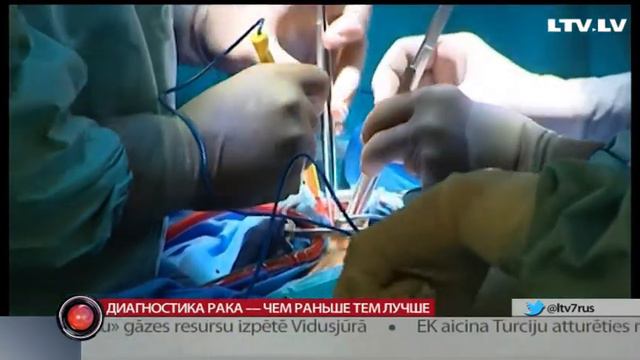 Диагностика рака — чем раньше тем лучше смотреть онлайн