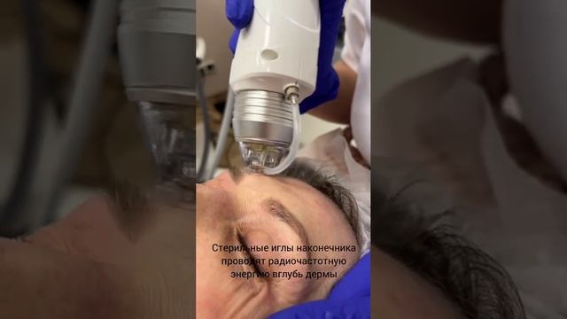 Одна из самых востребованных и действенных процедур в косметологии
