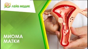 ?_? Миома матки у женщин