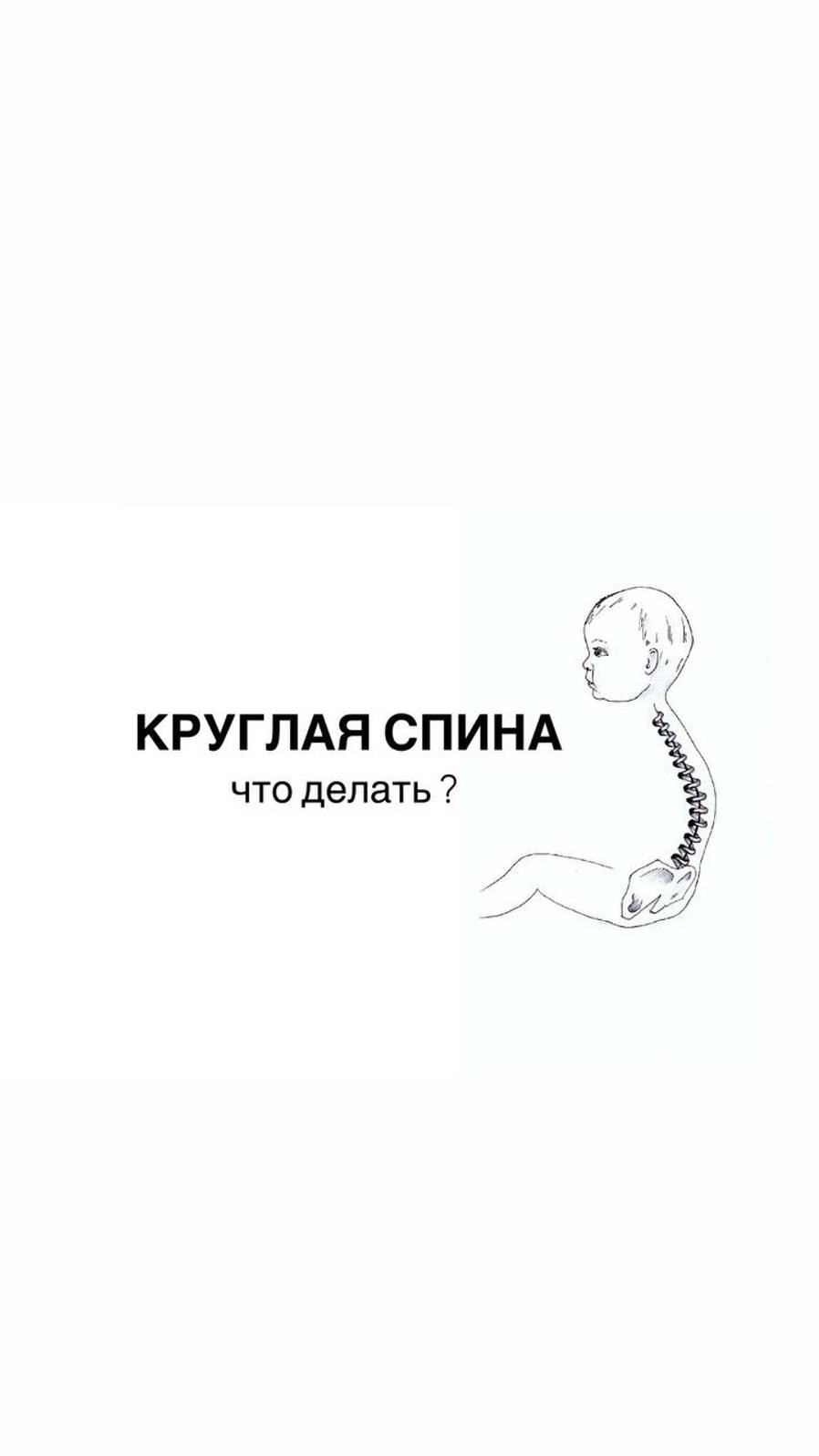 Круглая спина. Что делать?