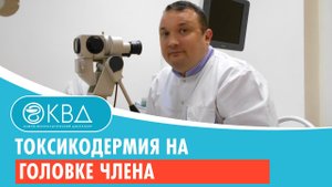 ? Токсикодермия на головке члена. Клинический случай №192