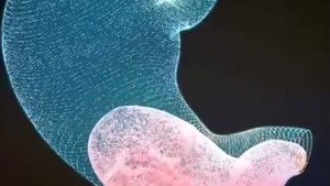 Сокращение желудка