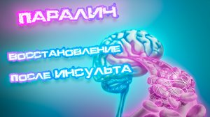 Паралич: Восстановление после инсульта и других неврологических повреждений.