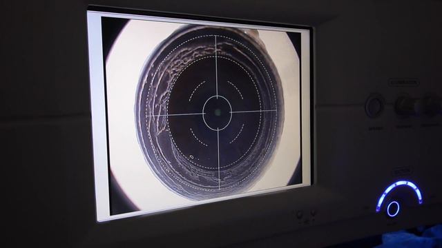 Eye Color Change from Dark to Light Brown with Kerato смотреть онлайн