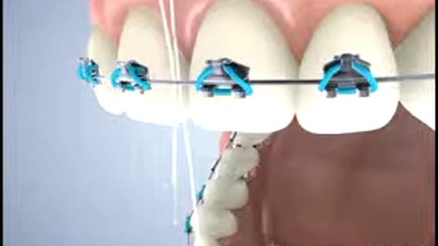 Флос 2 смотреть онлайн