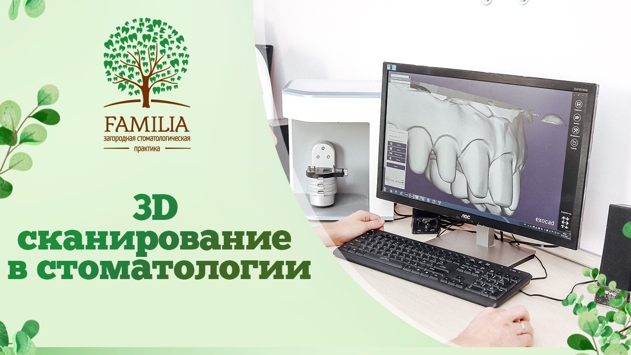 ? Цифровое 3D сканирование зубов в стоматологии Familia