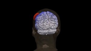 Транскраниальная электростимуляция