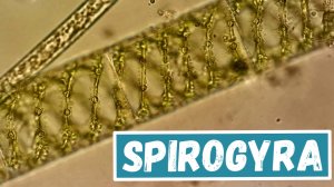 Spirogyra под микроскопом