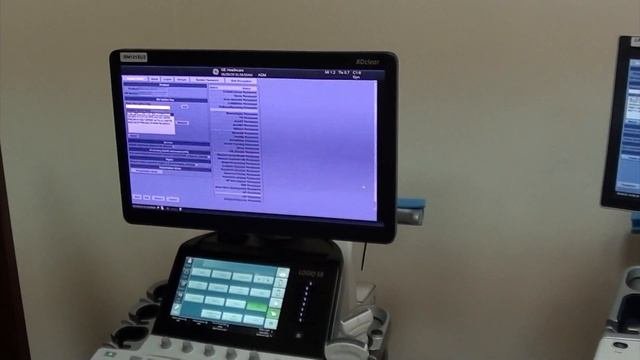 Logiq S8 R4