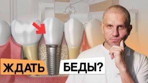 Как НУЖНО ухаживать за ЗУБНЫМИ ИМПЛАНТАМИ? Не допускай ЭТУ ОШИБКУ!