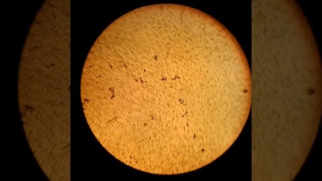 Аквариумная вода под микроскопом смотреть онлайн