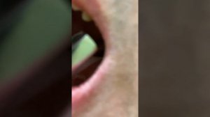 Как удалить зуб самостоятельно