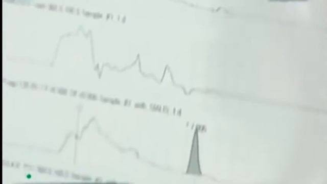 Бады Sealex и Аликапс запрещены в России