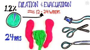 Что на самом деле происходит во время аборта [AsapSCIENCE]