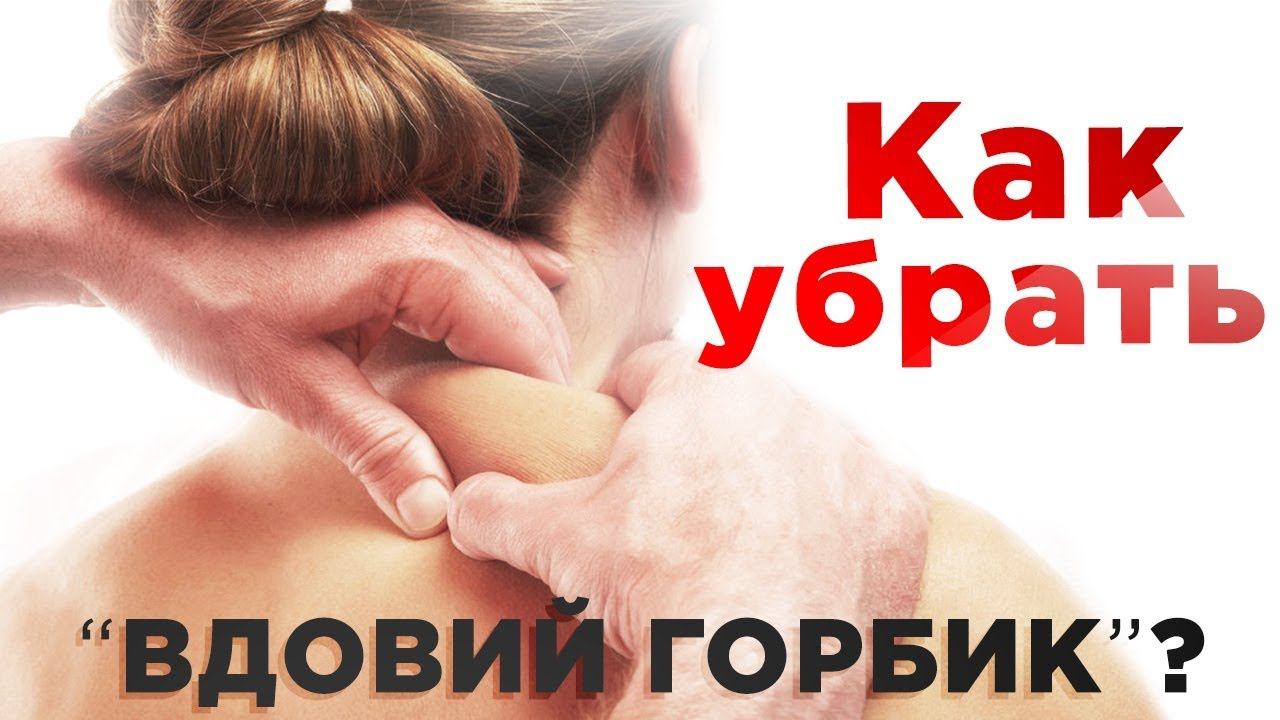 Как убрать вдовий горбик? Холка, шишка на шее - причины и методы лечения