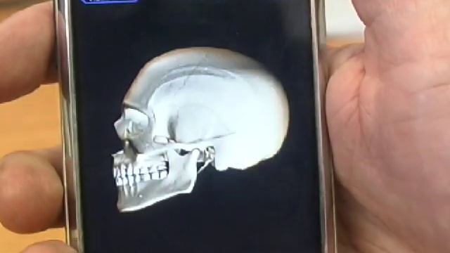 3D4Medical Skeleton System App Review смотреть онлайн