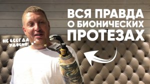 Вся правда о бионических руках