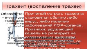 Трахеит у взрослых