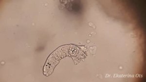 Болезни рыб - ЗОЛОТАЯ РЫБКА ПЕРЕВЕРТЫШ Аквариум / Fish disease - sick goldfish