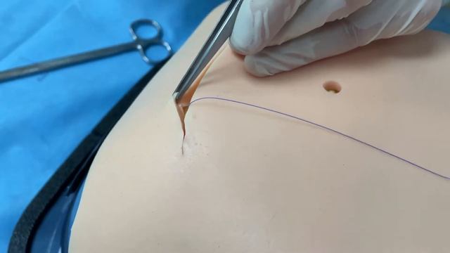 Косметический шов смотреть онлайн