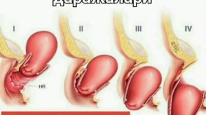 КИНДАН БАЧАДОН ЧИКИШИ.QINDAN BACHADON CHIQISHI..