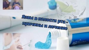 Язвы в полости рта - причины и лечение