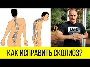 Как исправить сколиоз. [Комплекс упражнений]