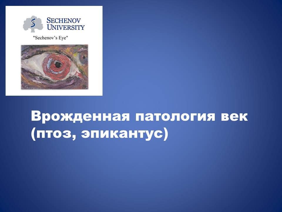 Врожденная патология век